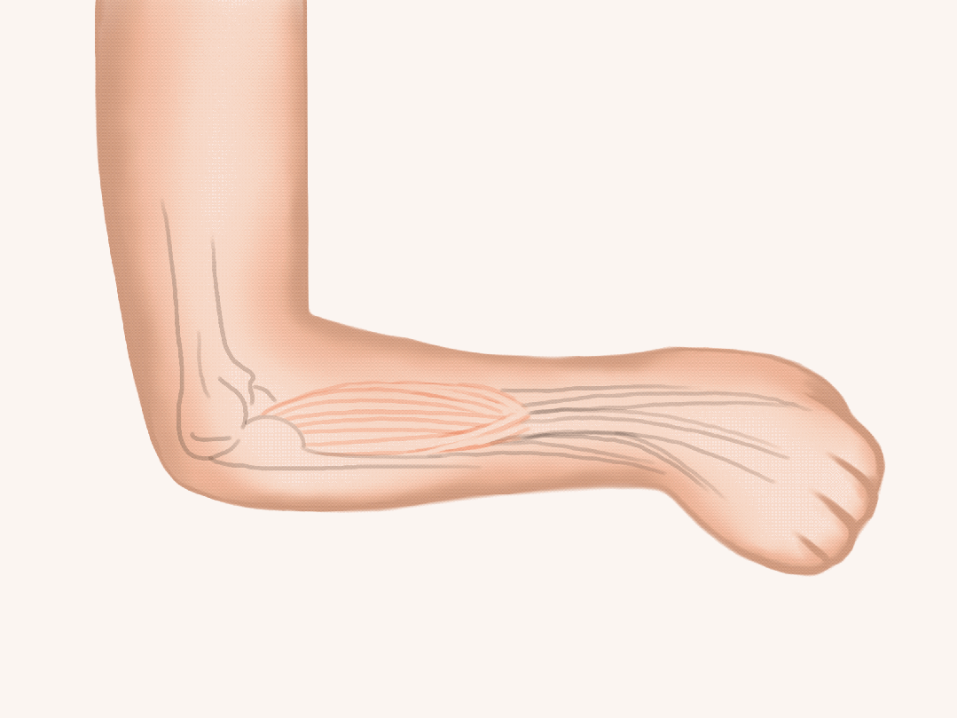 中小学生避险指南__糖尿病运动指南