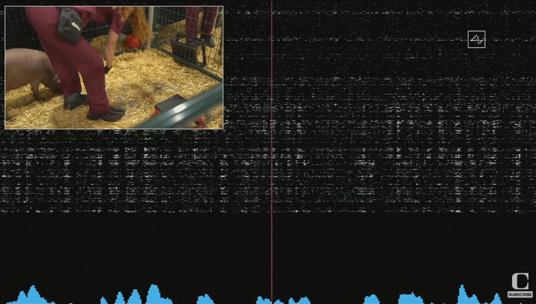 首例人类大脑芯片已植入！马斯克：目标是让霍金们快速沟通