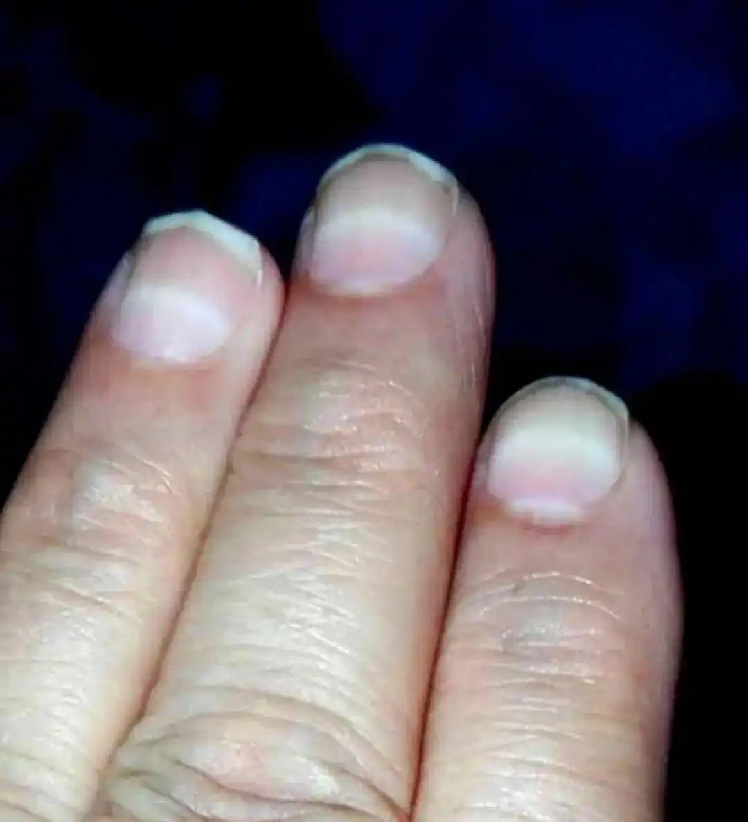 棉花药物中毒怎么办_走路有踩棉花感觉原因_